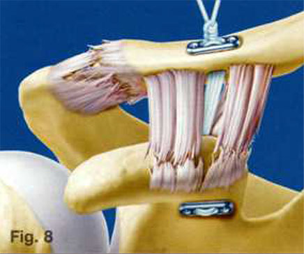 ce unguente ajută la artroza articulațiilor genunchiului